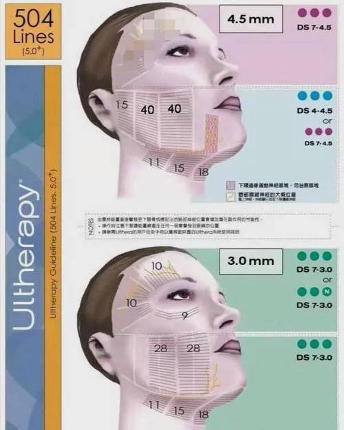 超声刀美容：原理与作用全解析